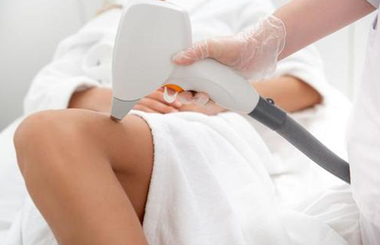 激光脫毛，女生腿毛長是一種怎樣的體驗？