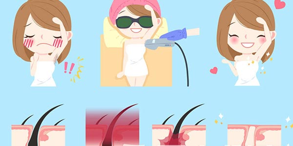 家用光子脫毛儀代工生產