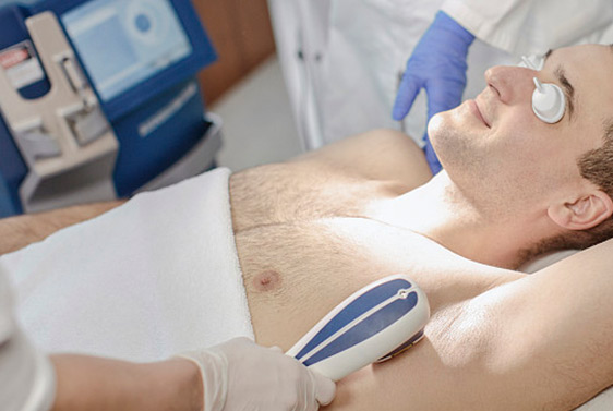 在家脫毛：不僅女性要脫毛，男性也逃不掉(圖3)