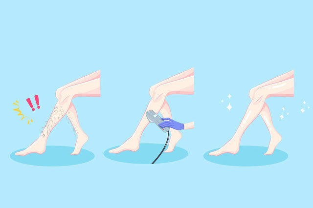 脫毛儀器生產(chǎn)廠家