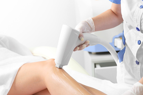 脫毛器的優勢所在