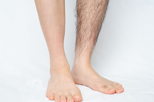 美容院用的脫毛儀哪個牌子好(圖2)