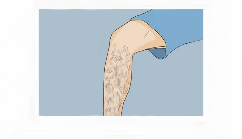 如何去除體毛不再生長(圖1) 如何去除體毛不再生長(圖1)